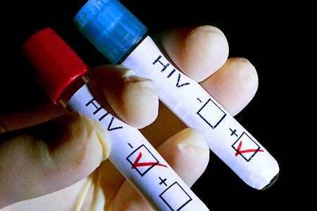 Resultado de imagem para fotos de teste de hiv