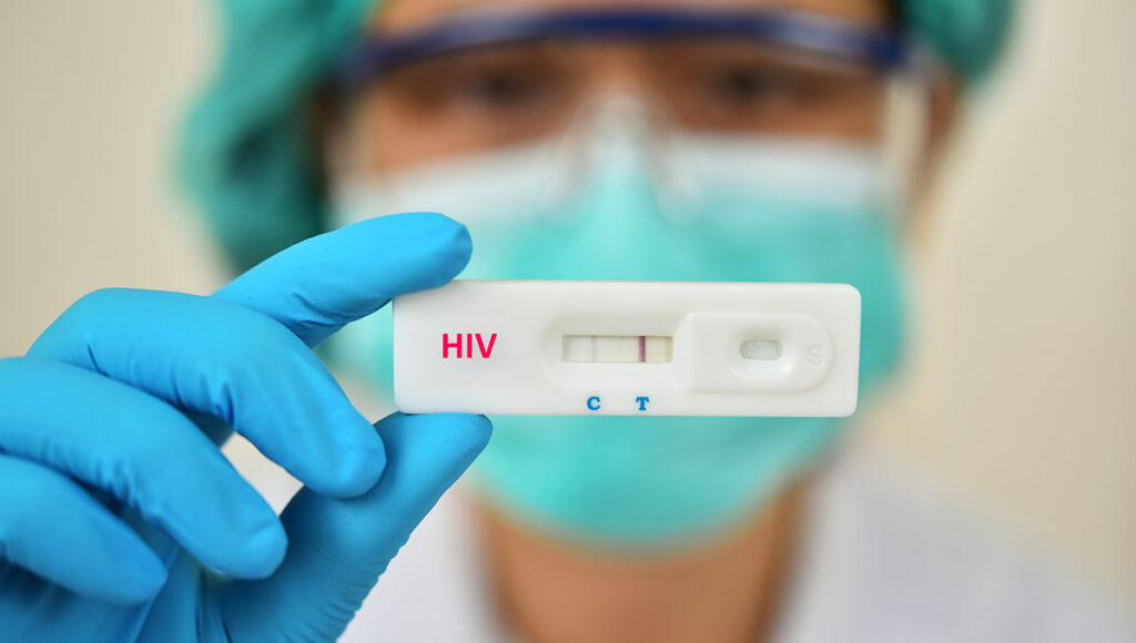 Ministério da Saúde Testes rápidos no SUS permitem diagnósticos em até minutos Agência AIDS