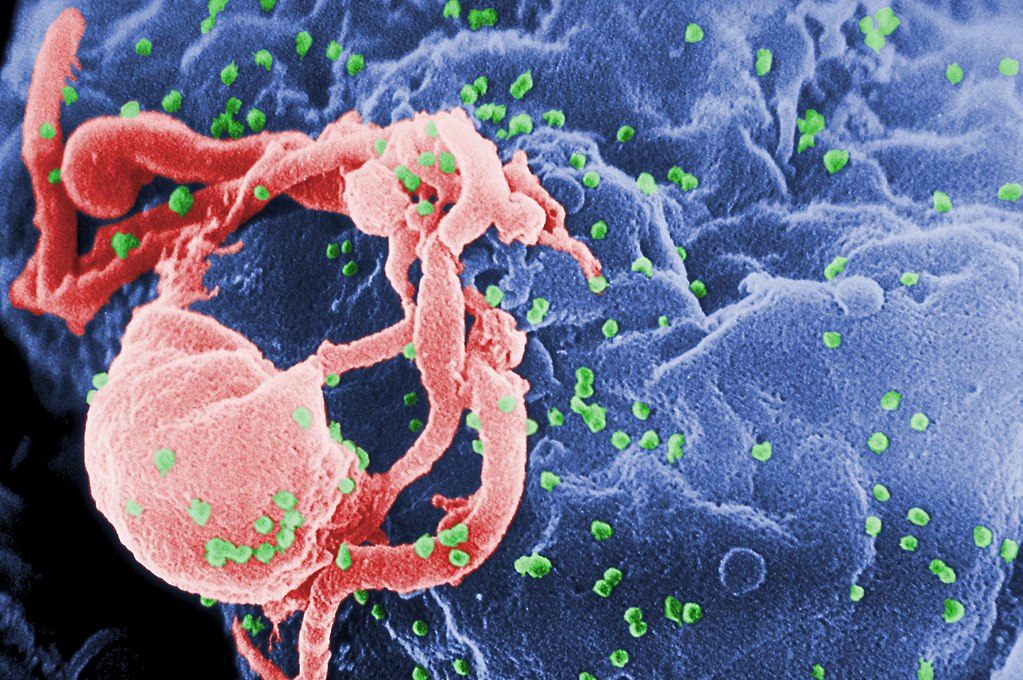 HIV-célula