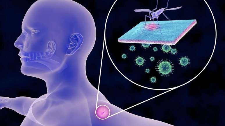 Evento debate doenças infecciosas