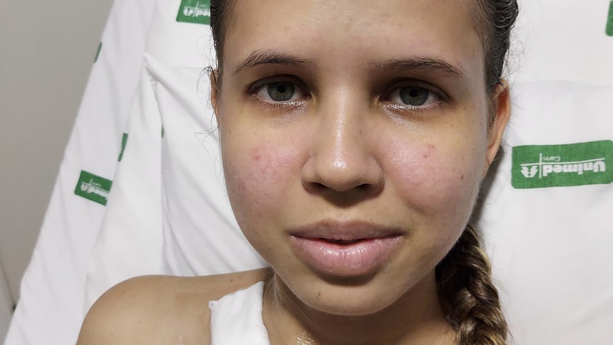 Ana Karoline está curada da infecção, mas faz tratamento para lúpus e doença de Kikuchi-Fujimoto (DKF)