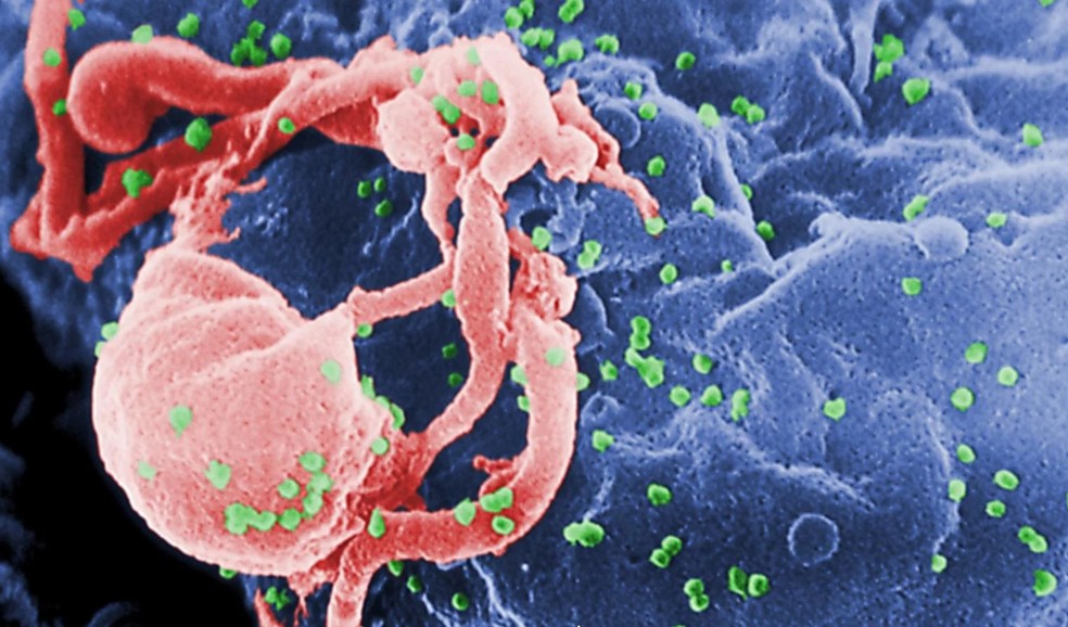 Estudo mostra que quatro crianças permeneceram livres do HIV um ano após pausar tratamento — Foto: Estudo