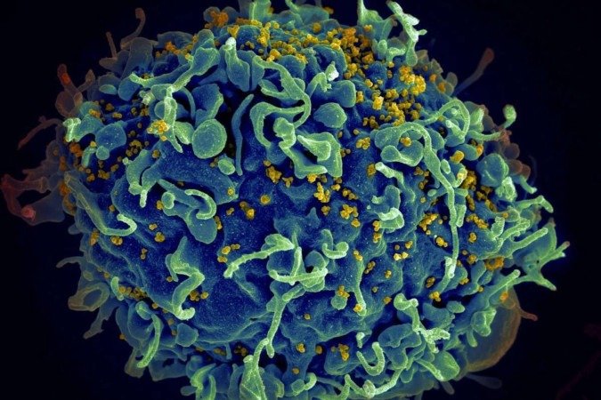 O vírus da imunodeficiência humana (HIV) é um retrovírus com capacidade de mutação muito rápida - (crédito: National Cancer Institute/Unsplash)