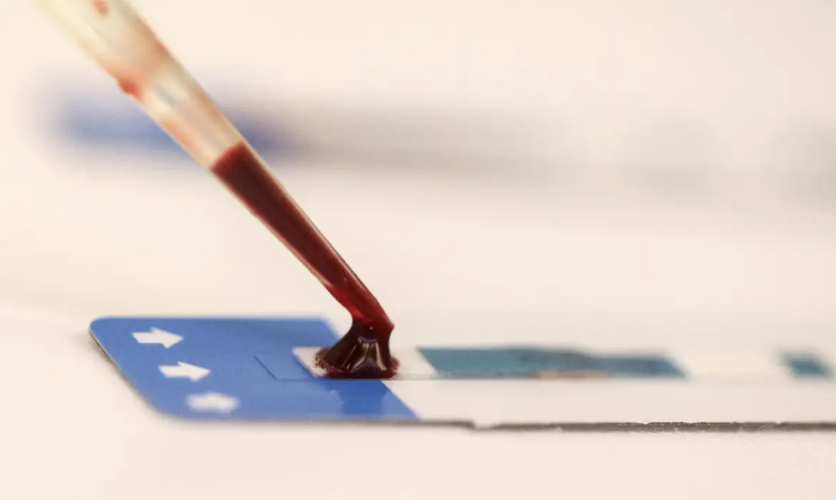 Teste de HIV