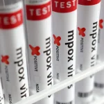 Brasil registra 88 casos de Mpox em 2026; saiba como evitar a doença