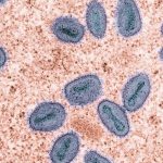 Portal Terra: Mpox deixa de ser emergência de saúde internacional, diz chefe da OMS