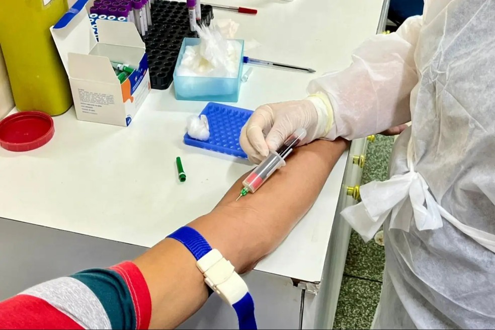 Número de pessoas com HIV aumentou no Amapá — Foto: Gea/Divulgação