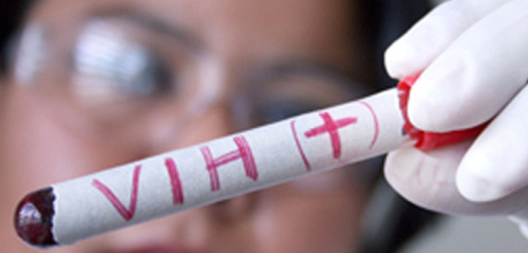 Taxas de mortalidade e de casos por Aids têm redução no Paraná |