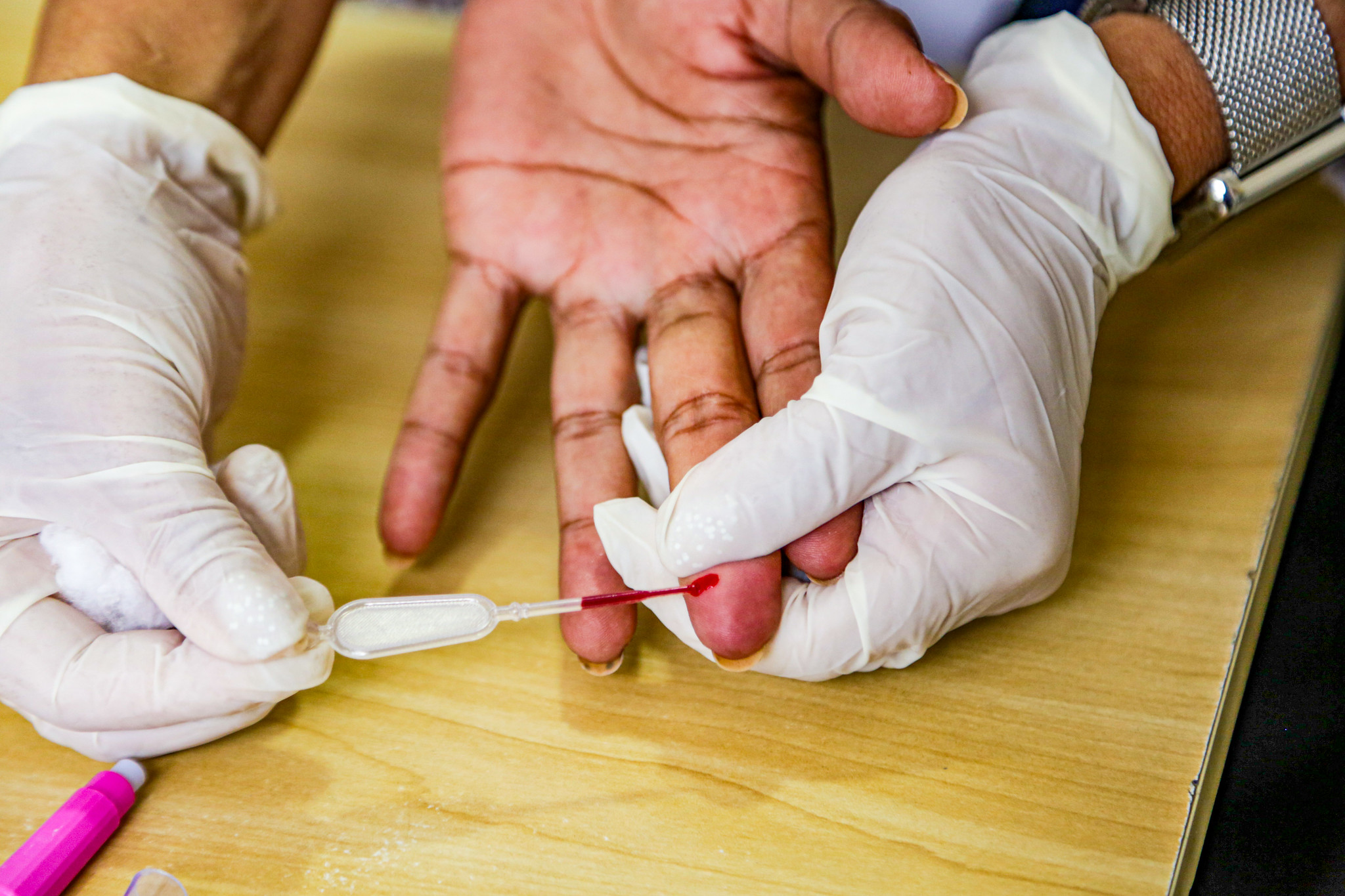 Prefeitura de Itapevi oferece testes rápidos para detectar HIV e ISTs - Agência Itapevi de Notícias