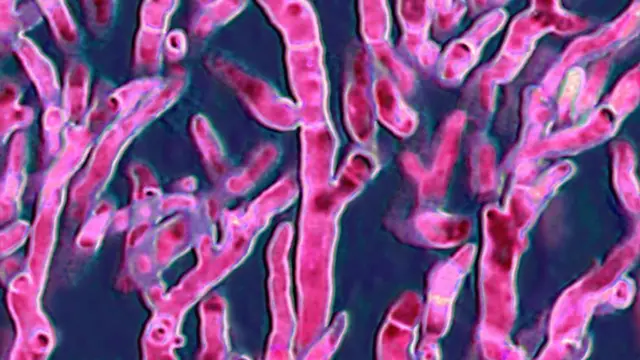 Aspergillus fumigatus, fungo responsável por graves infecções em aves e seres humanos, como aspergilose bronquiopulmonar e aspergiloma