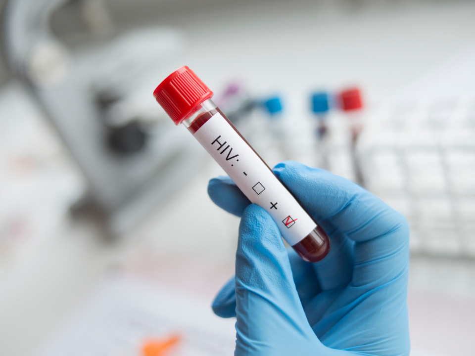 Resultado de HIV: Você entrega em mãos? | Newslab