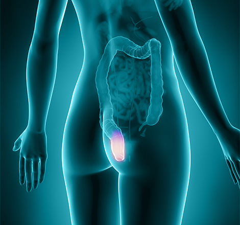 Câncer de Ânus | Centro de Oncologia Oswaldo Cruz