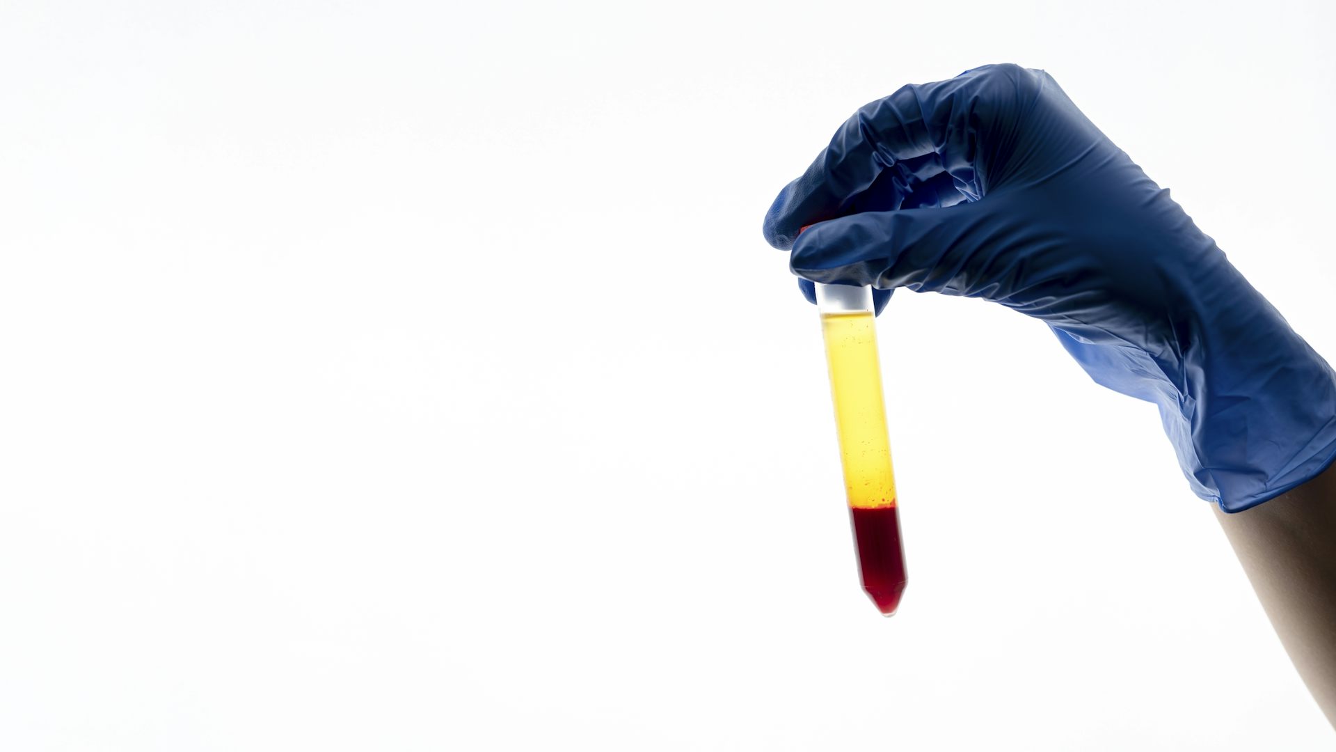 Saúde: Aprovação da PEC do Plasma pode trazer retrocesso em combate à desigualdade. Entenda