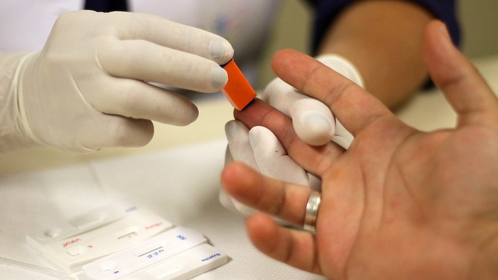 O diagnóstico de sífilis é rápido — Foto: Rodrigo Nunes/MS