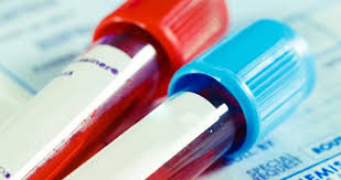 Departamento de DST, Aids e Hepatites Virais do MS publica nova edição do Manual Técnico para o Diagnóstico das Hepatites Virais | CRBio-08 - Conselho Regional de Biologia - 8ª Região