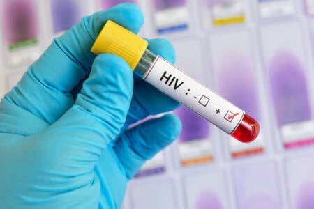A Síndrome Retroviral Aguda é um sinal precoce da infecção pelo HIV e pode ser facilmente confundida com outras doenças virais