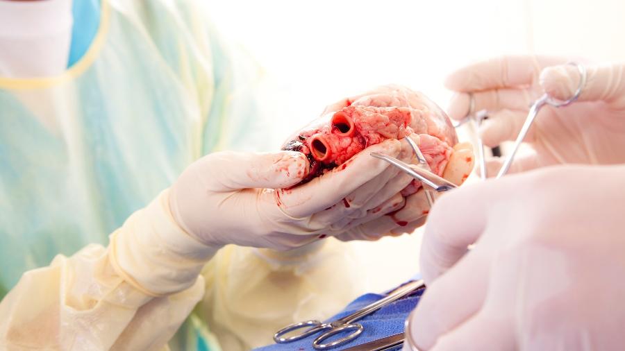 Hoje, no Brasil, o transplante de órgãos de pessoas com HIV não é permitido