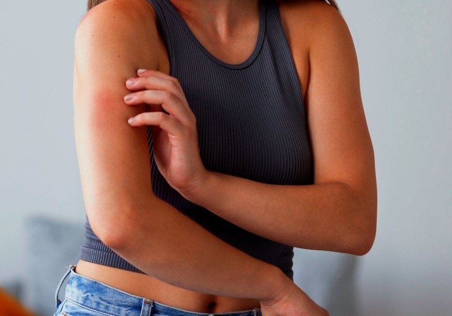 Hanseníase tem cura