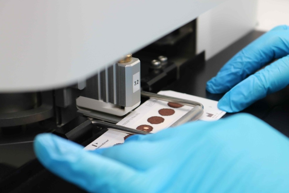 Exame laboratorial — Foto: Rafael Marques/Hemoam