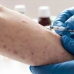 Sífilis inicial pode ser curada com apenas uma dose de penicilina, mostra estudo divulgado pelo Correio Braziliense