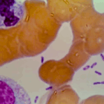 O Globo: A 1ª pandemia da humanidade: cientistas resolvem mistério de 1,5 mil anos e identificam origem da doença
