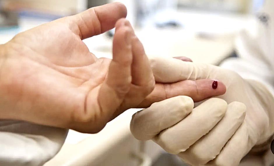 Tratou uma IST? Parcerias sexuais também devem procurar atendimento para evitar reinfecção, alerta Ministério da Saúde
