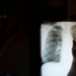 Folha de S. Paulo: Hospitais de SP usam inteligência artificial para otimizar procedimentos