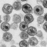 Deutsche Welle: Cientistas alemães identificam anticorpo capaz de bloquear o HIV e impedir sua replicação