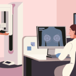 Mamografias pelo SUS alcançam menos de 40% das mulheres de 50 a 69 anos, informa Folha de S. Paulo