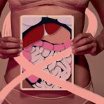 Câncer colorretal: 4 novos estudos apontam avanços no tratamento — Veja Saúde