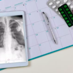 Deutsche Welle: Com aumento de casos registrados, Brasil não atinge meta da OMS para reduzir casos de tuberculose