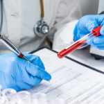 Pequeno estudo mostra caminho promissor rumo a uma cura para o HIV, divulga Estadão