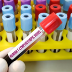 Ministério da saúde publica nota técnica com orientações para a prevenção da transmissão vertical do HTLV