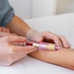 Após o carnaval, especialistas alertam para ISTs sem sinais aparentes e defendem testagens