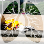 Tuberculose, pobreza e HIV: Mopaids cobra respostas estruturais e denuncia desigualdades no Brasil