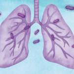 Sociedade civil cobra do Ministério da Saúde retomada urgente de campanhas massivas contra a tuberculose no Brasil