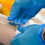 Rússia recomenda ampliar testagem de HIV para conter avanço de casos – The Moscow Times