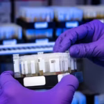 Câncer de colo de útero: teste molecular de HPV, que vai substituir Papanicolau no SUS, identifica quase 4 vezes mais casos da infecção – O Globo