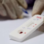Controle do HIV sofre retrocessos que precisam ser combatidos, alerta a ONU – Galileu