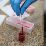 Em um relacionamento, ter HPV significa traição? Entenda como o vírus age – Folha de S. Paulo