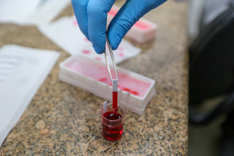 Em um relacionamento, ter HPV significa traição? Entenda como o vírus age – Folha de S. Paulo