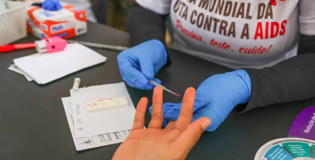 Jota: A nova era da prevenção rumo ao combate do HIV no Brasil – por Dr. Álvaro Costa