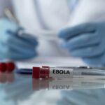 OPAS reforça preparação nas Américas diante de surto de ebola na África