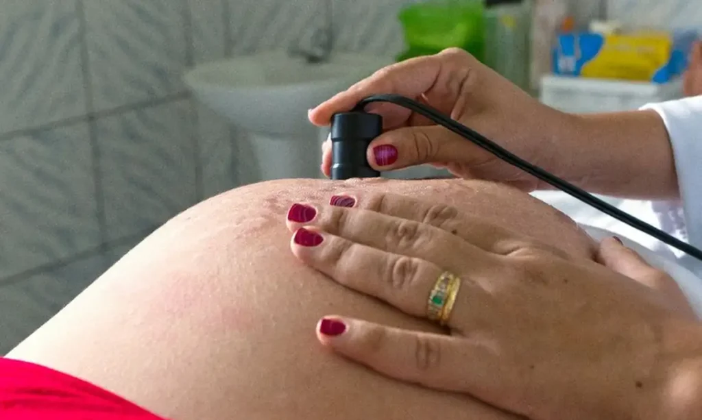 Risco de morte materna cai até 31% entre quem recebe o Bolsa Família – Agência Brasil