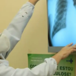 Alerta tuberculose: doença infecta mais de 80 mil pessoas por ano – Tribuna