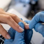 Julho Amarelo alerta para risco de hepatites na manicure – Terra