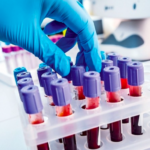 Quais exames fazem parte do acompanhamento de quem vive com HIV? Entenda por que eles são importantes