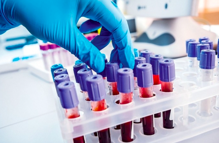 Quais exames fazem parte do acompanhamento de quem vive com HIV? Entenda por que eles são importantes