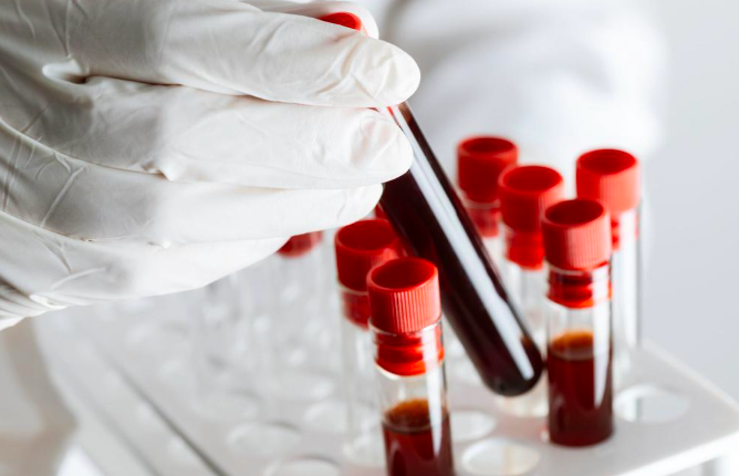 Especialistas publicam primeiras recomendações internacionais para orientar manejo da viremia de baixo nível no HIV