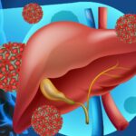 Risco de reativação de hepatite B oculta em pessoas vivendo com HIV – Portal AFYA